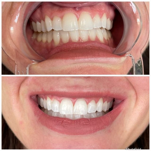 Marcie Mitton Teeth Whitening & Permanent Jewelry